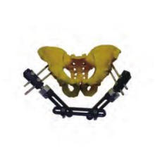 Medical Orthopedic Pelvis External Fixator